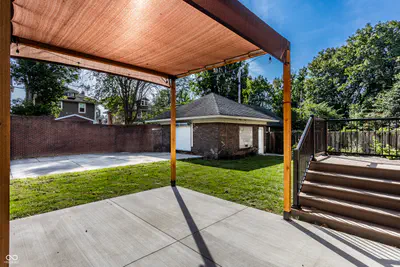 3139 N Pennsylvania Street, Indianapolis - 30