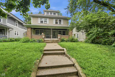 518 Woodruff Pl E Drive, Indianapolis